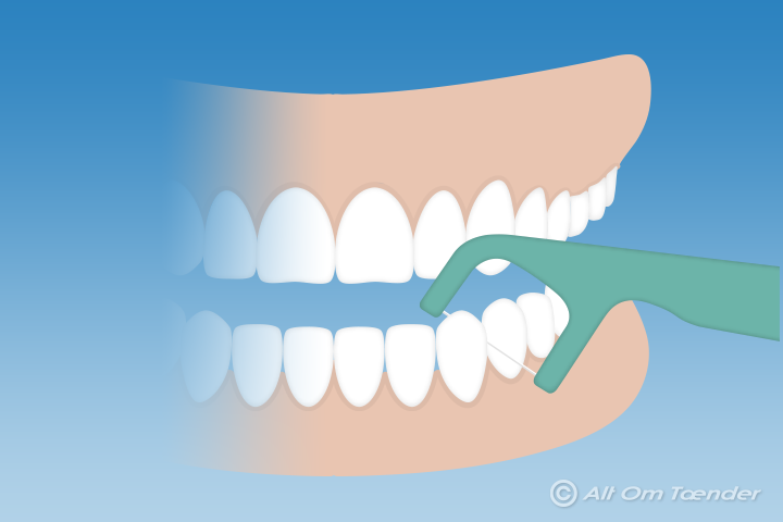 Angreb Mania Kedelig Tandtråd | Alt Om Tænder